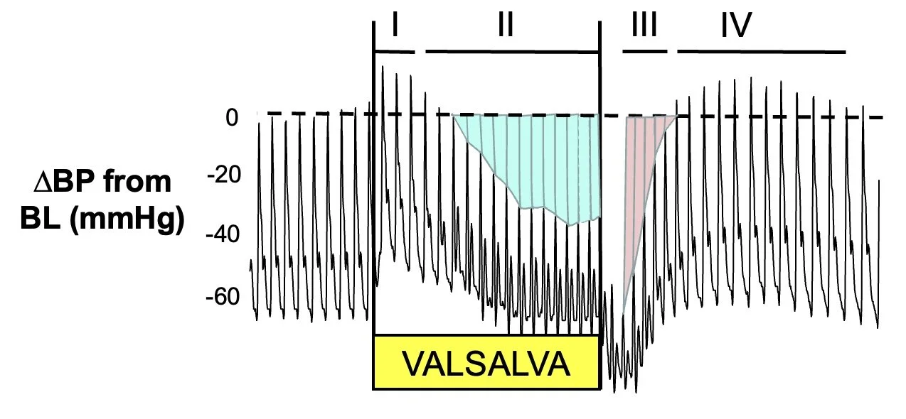 Valsalva trace diagram for baroreflex areas method